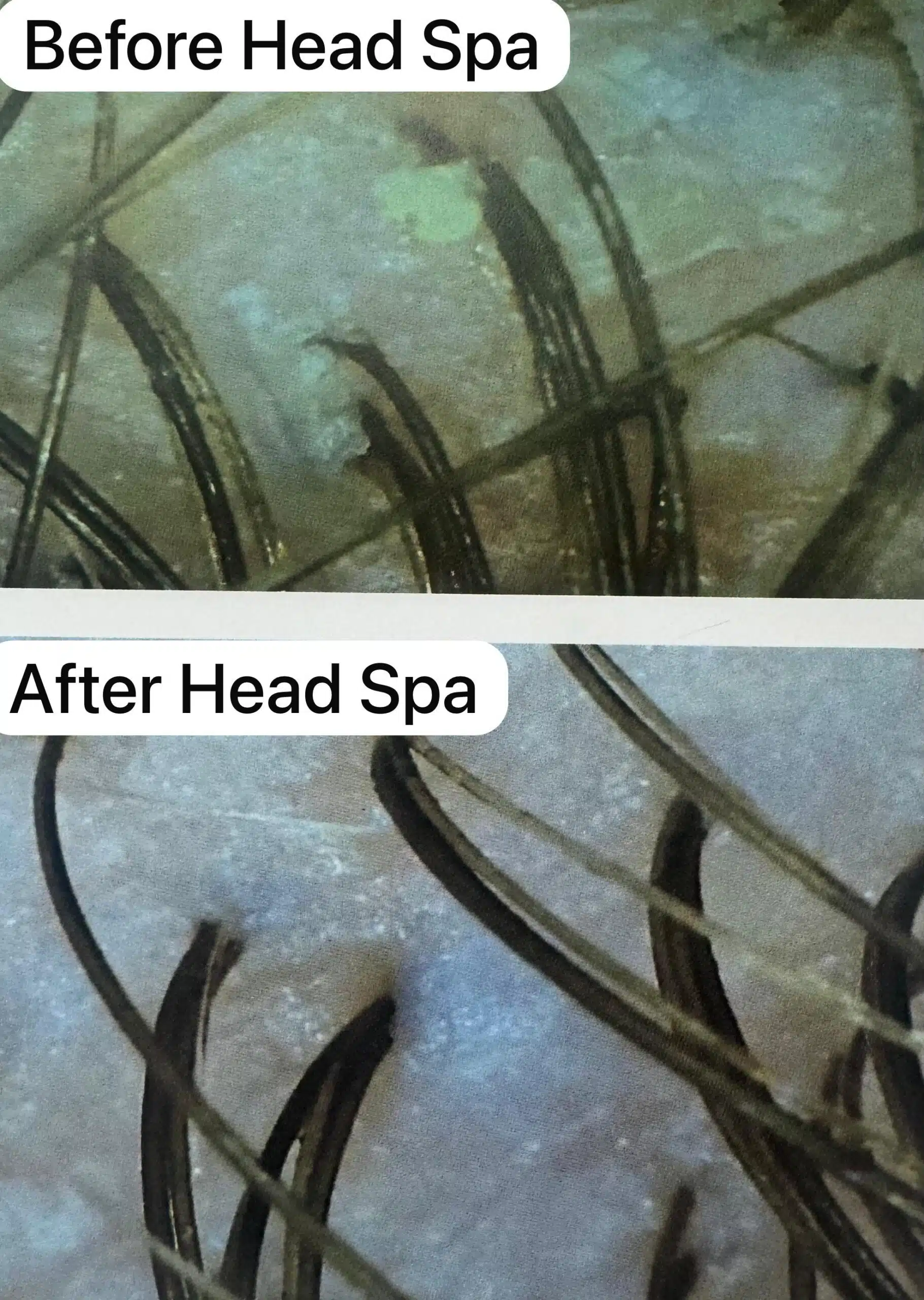 head spa treatment toronto before and after