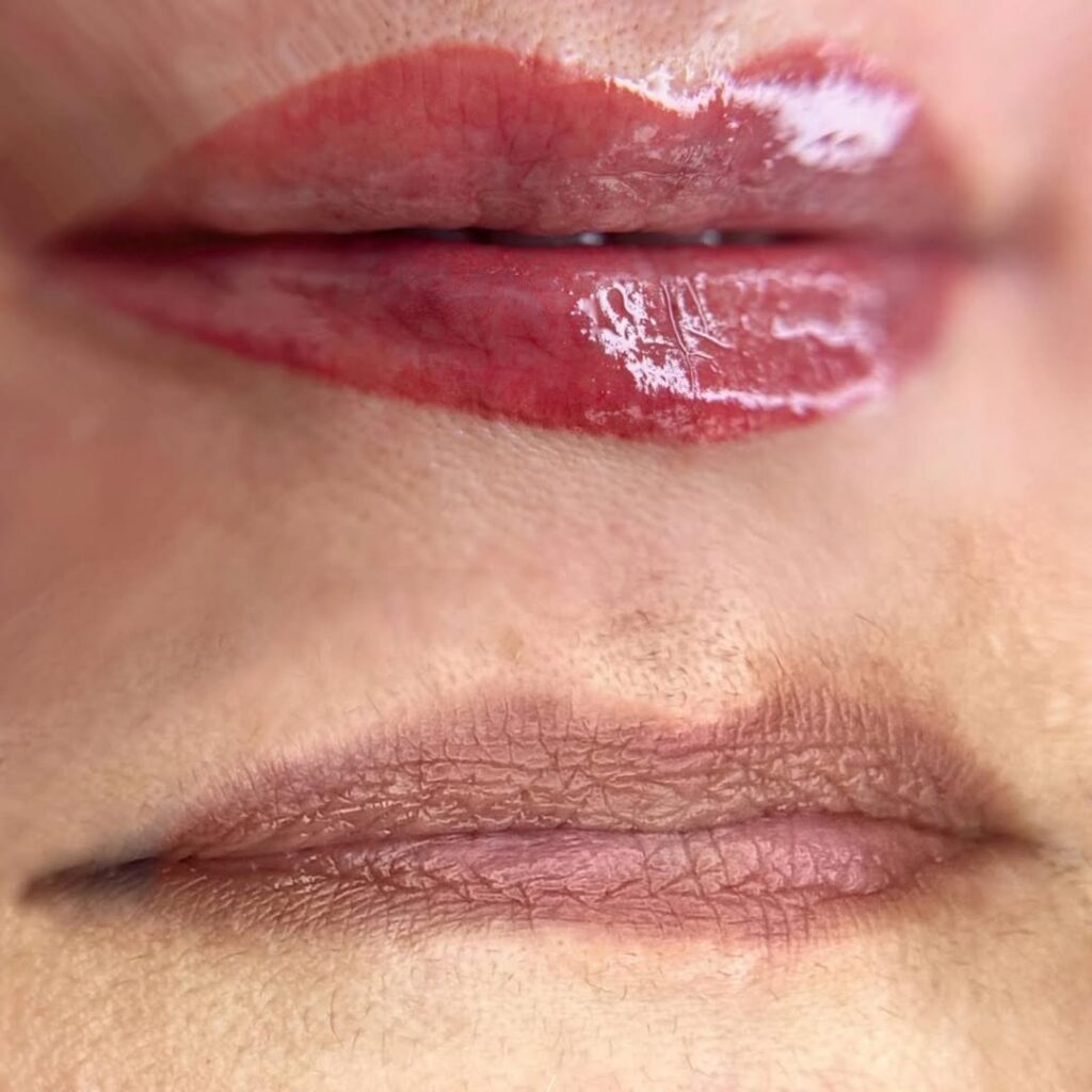 Healed Lip Blush result A soft, natural color boost that stays with you — no lipstick needed by Adeleh Beauty